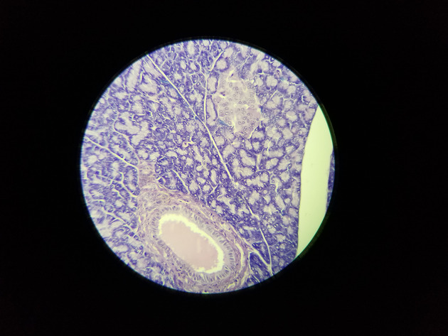 Pancreas Slides - Pancreas 009 100X